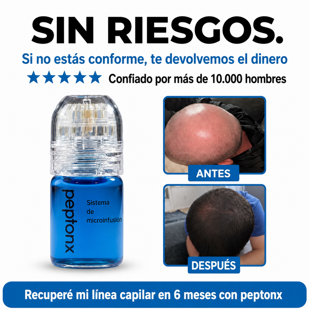 Peptonx® – Sistema de Microinfusión Capilar con Péptidos de Cobre