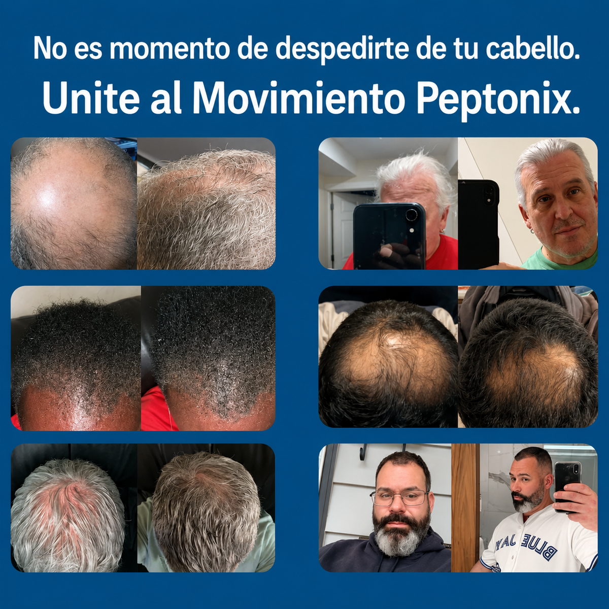 Peptonx® – Sistema de Microinfusión Capilar con Péptidos de Cobre
